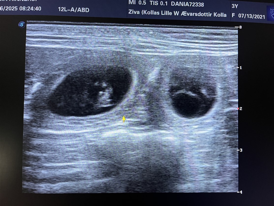 To hvalpe i Ziva´s mave på dag 26 <3